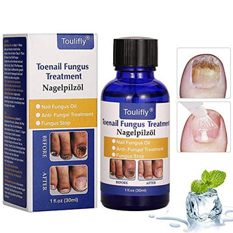 Astonish Stain Remover Bar 75g